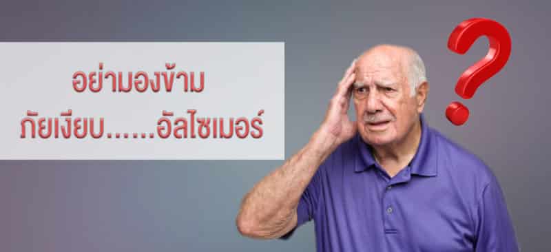 อัลไซเมอร์